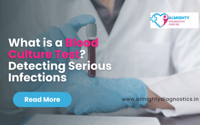 What is a Blood Culture Test? Detecting Serious Infections