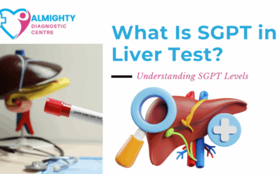 What Is SGPT in Liver Test? | Understanding SGPT Levels